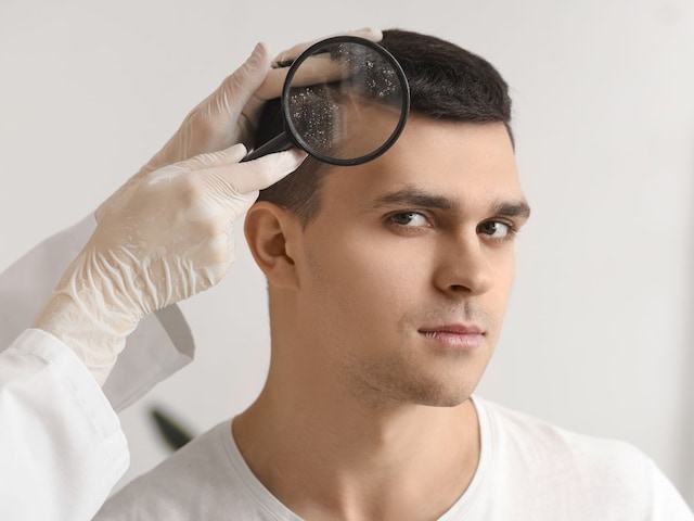 চুলের খুশকি দূর হবে বলে মনে হচ্ছে না? ডাক্তারের কাছ থেকে এর আসল কারণ বুঝে নিন