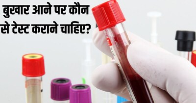 बुखार आने पर सीबीसी, डेंगू, मलेरिया और टाइफाइड टेस्ट जरूर कराएं.