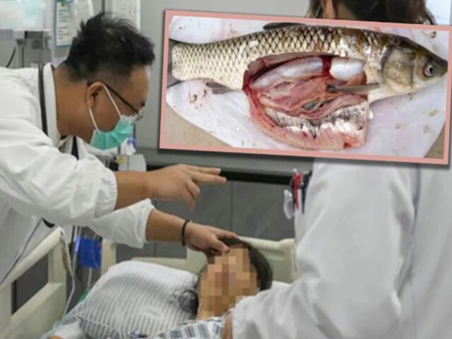 तेज सिरदर्द हुआ, दवा की जगह निगल लिया कच्ची मछली का पित्ताशय, हुआ ऐसा