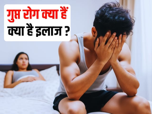 What are venereal diseases? After all, why are people shy in telling these things?