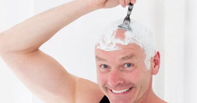 अगर बाल झड़ रहे हैं, तो सिर मुंडवाने से कोई फायदा नहीं होता है.