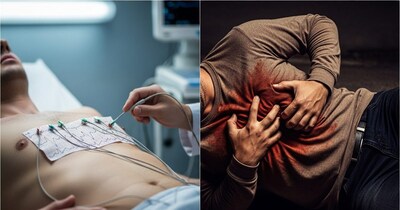 सामान्य ECG के बावजूद न्यूरोसर्जन की मौत: क्या छिपे हैं हार्ट अटैक के खतरे?