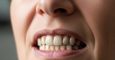 पीले दांतों की वजह विटामिन की कमी? डाइट और घरेलू नुस्खों से पाएं चमक.