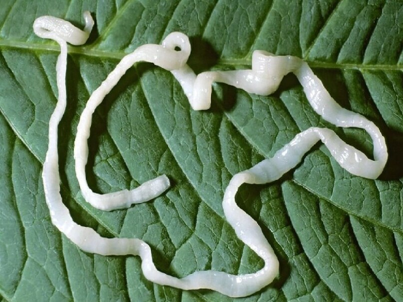  নয়ডার মেট্রো হাসপাতালের সিনিয়র নিউরোলজিস্ট ডাঃ নীরজ কুমার বলেন, আমাদের খাদ্যতালিকায় রয়েছে শীতকালে পাওয়া যাওয়া এমন ৪ সবজি, যাতে কিলবিল করে ফিতাকৃমি বা টেপওয়ার্ম, কোন ৪ সবজি খাওয়ার আগে সাবধান?