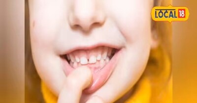 दांतों के दर्द और महंगे इलाज से पाएं छुट्टी: एक्सपर्ट के 4 टिप्स बचाएंगे हजारों रुपये