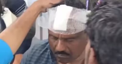 धार के भाजपा विधायक के सिर पर चोट आई है. 