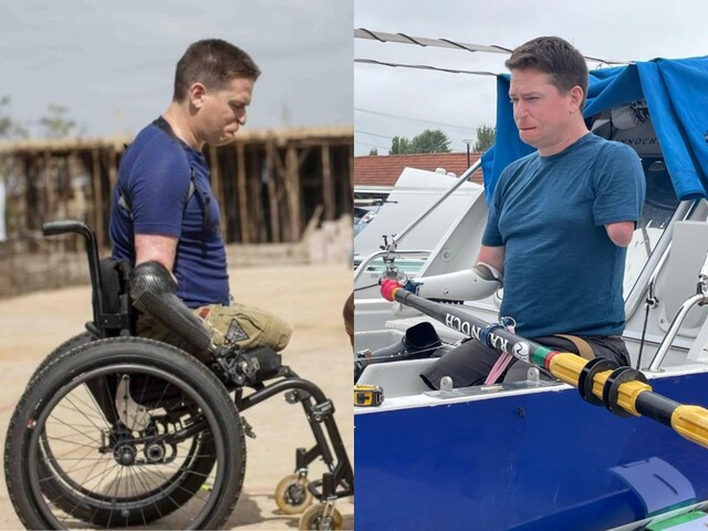 शख्स को लगी ठंड, मामूली बात समझकर पहुंच गया अस्पताल जब शरीर पड़ने लगा बैंगनी!