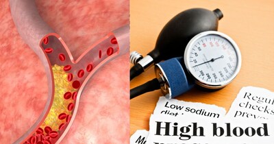 हार्ट हेल्दी रखने के लिए बीपी और कोलेस्ट्रॉल कंट्रोल करना जरूरी है.