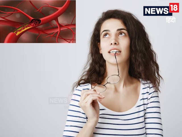 Cholesterol and sugar can also increase due to teeth! Top Dental Surgeon of Delhi...