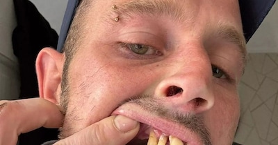 दांतों की वजह से लंबे समय से सिंगल था शख्स (इमेज- फाइल फोटो)