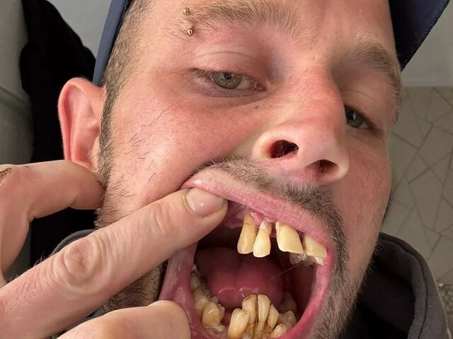 लड़कियाँ आदमी के दाँत देखते ही भाग जाती थीं, कहती थीं 'छी', आज मेरे पीछे पड़ गईं!