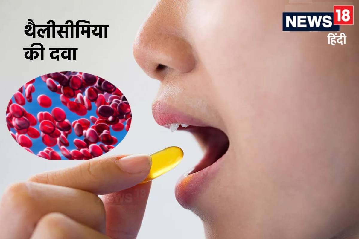 थैलीसीमिया मरीजों के लिए पहली ओरल ड्रग मंजूर क्या अब मरीज को नहीं चढ़ेगा बार-बार खून फायदे से कीमत तक जानें हर सवाल का जवाब