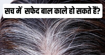 डॉक्टर के अनुसार सफेद बालों को दोबारा काला करना संभव नहीं है.