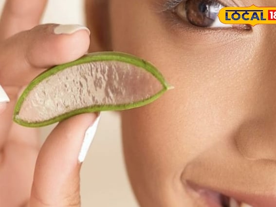 झाइयों और काले धब्बों से हैं परेशान? अपनाएं एलोवेरा के आसान घरेलू उपाय