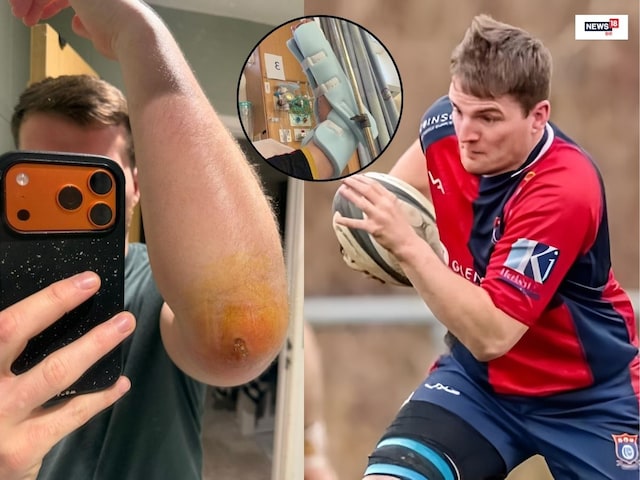 रग्बी स्टार के साथ घिनौना हादसा, कुत्ते की पॉटी में गिरते ही सड़ने लगा शरीर