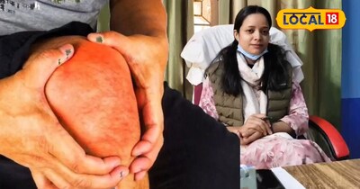 जोड़ों के दर्द और आर्थराइटिस से राहत के लिए अपनाएं ये घरेलू उपाय.