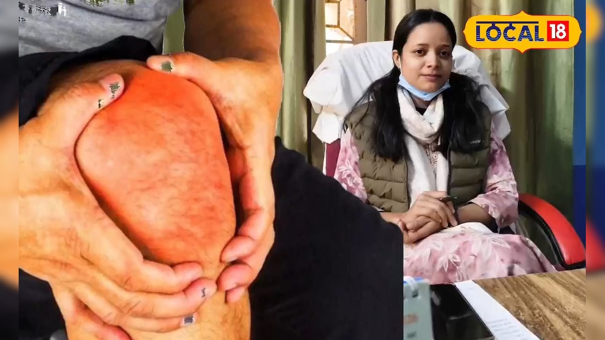 जोड़ों के दर्द और आर्थराइटिस में राहत के लिए अपनाएं ये घरेलू उपाय