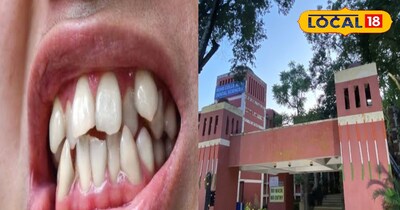 TMJ क्लिनिक 