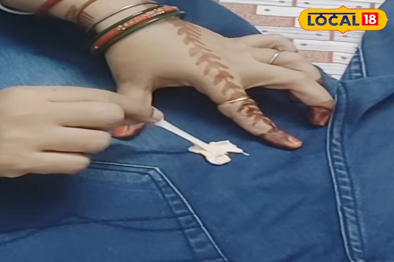 कपड़ों से चिंगम हटाने का आसान तरीका