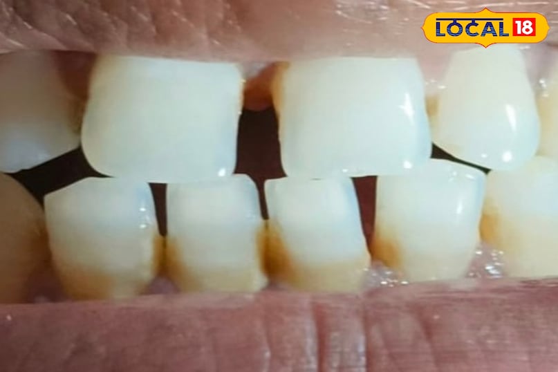 স্থানীয় 18