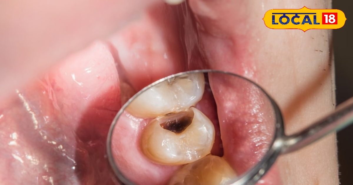 मीठा खा रहे हैं बेफिक्र? दांतों में चुपचाप लग रहा है कीड़ा, जानें कैसे बचें