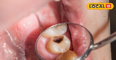 दांत की देखभाल <br>