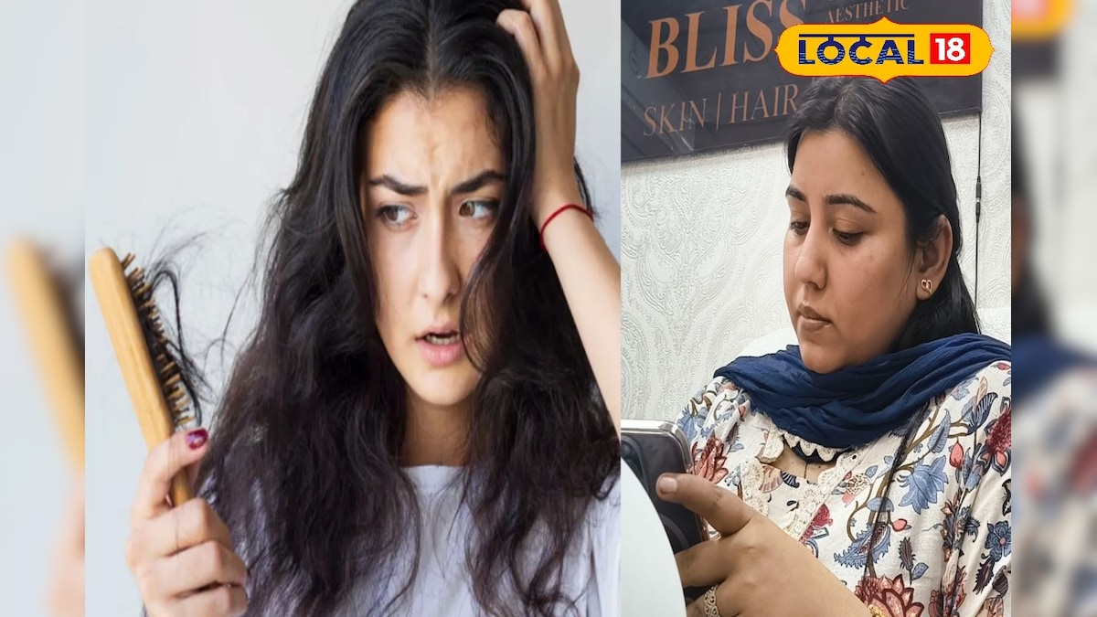 Hair Fall: क्यों झड़ते हैं महिलाओं के बाल? पुरुषों में हेयरफॉल की होती हैं कई वजहें, यह है इलाज