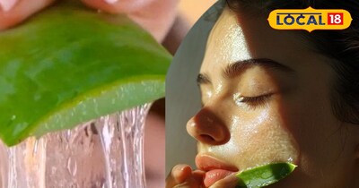चेहरे पर एलोवेरा लगाने से हाइपर पिगमेंटेशन में राहत 