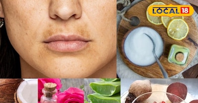 घरेलू उपाय 