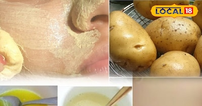 बिना केमिकल, सिर्फ प्राकृतिक देखभाल: आलू से निखरेगी आपकी त्वचा...