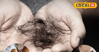 दादी नानी के यह घरेलू नुस्खे देंगे 1 महीने में रिजल्ट 