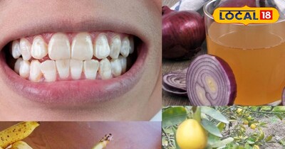 देसी नुस्खे 