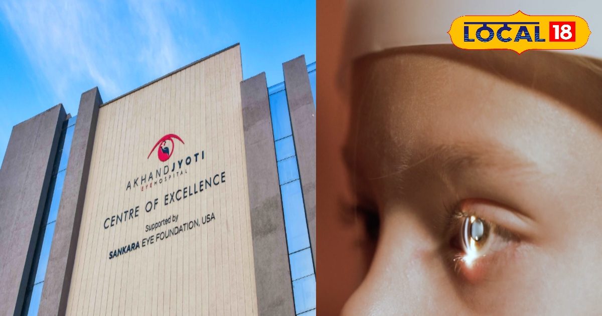 पूर्वी भारत के सबसे बड़े 5 स्पेशलिस्ट डॉक्टर करेंगे आंखों की जांच