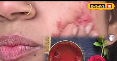 चुकंदर फेसपैक स्किन डेड सेल्स को देता है पुनर्जन्म 