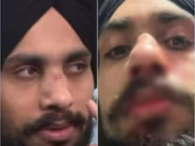 'मुझे इंडियन डॉग कहा', विदेश में भारतीय लड़के पर हुआ अटैक, खूनम-खून किया चेहरा