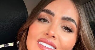 दुबई में दांतों की सर्जरी बनी महिला के लिए नरक, सुंदरता की चाहत में गंवाए दांत और पैसे.