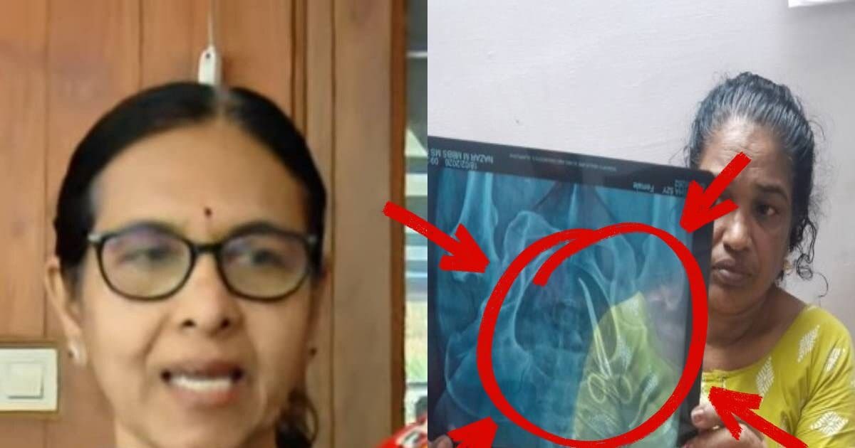'50 साल तक भी कुछ नहीं होगा', मरीज के पेट में किसने छोड़ दी कैंची, डॉक्टर ने दी सफाई