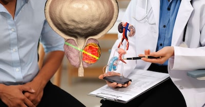 शुरुआत में ही प्रोस्टेट की दिक्कत को दिखाना चाहिए. 