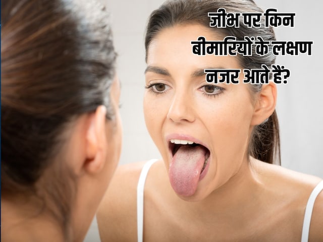 White layer on tongue is not normal, body is giving signs of these diseases