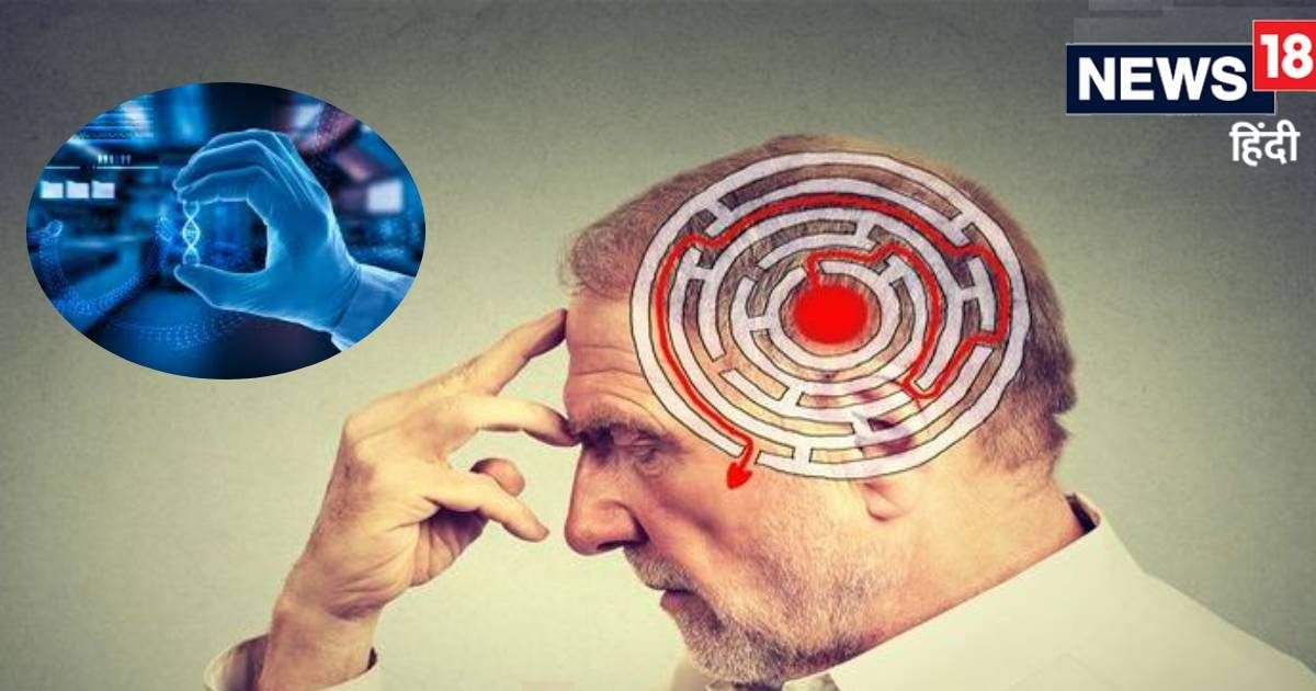 बीएचयू-एम्स के डॉक्टरों ने ढूंढ लिया अल्जाइमर्स बीमारी का ऐसा इलाज, दुनिया में कहीं नहीं, क्लिनिकल ट्रायल हुआ शुरू