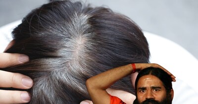 बाबा रामदेव के अनुसार सफेद बालों से राहत पाने के लिए शीर्षासन का अभ्यास करें.