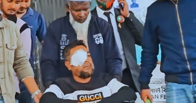 BNP नेता की दाहिनी आंख निकालने का दावा. 