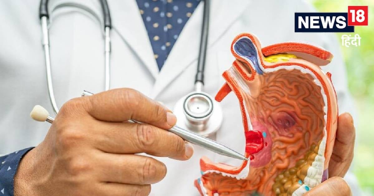 अब 30 मिनट में चलेगा कैंसर का पता, AI-स्मार्ट डिवाइस को लेकर दावा