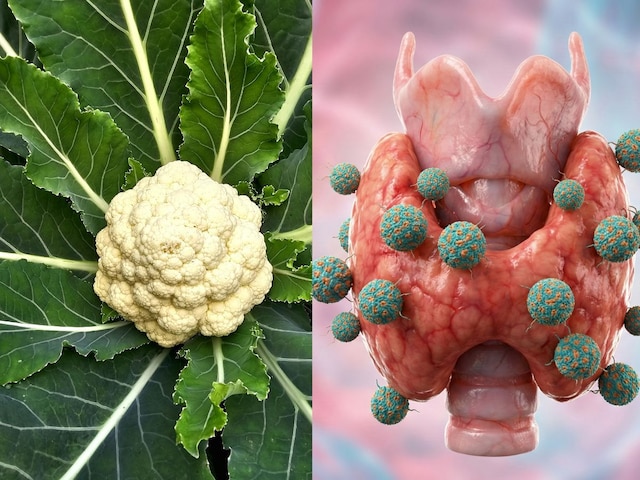 ফুলকপির পার্শ্বপ্রতিক্রিয়া: খুব বেশি ফুলকপি খেলে কী হয়? জেনে নিন ৫টি অসুবিধা