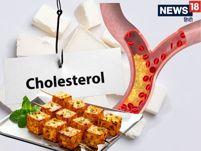 Does eating cheese increase cholesterol? Know the right way to eat