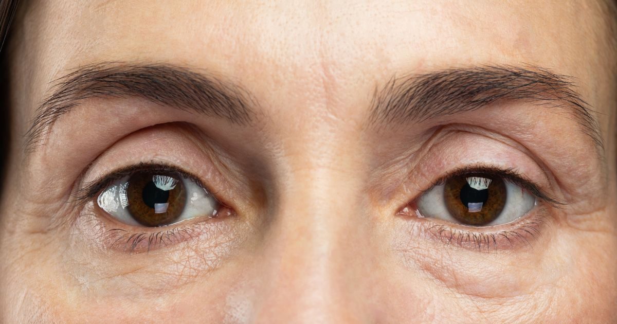 क्या है कोर्टिसोल फेस? सोशल मीडिया पर हेल्थ अवेयरनेस का नया मुद्दा, जानें क्या कहते हैं डॉक्टर