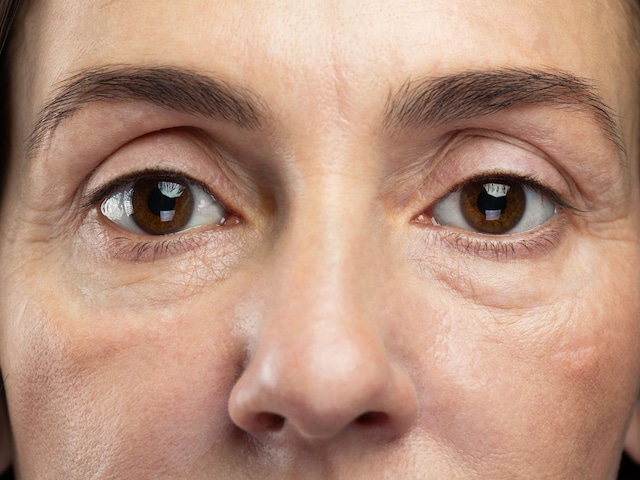 কর্টিসল মুখ কি? সোশ্যাল মিডিয়ায় স্বাস্থ্য সচেতনতার নতুন ইস্যু