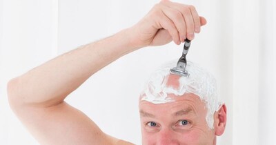 डॉक्टर की मानें तो डैंड्रफ की समस्या सिर मुंडवाने से दूर नहीं होती है.