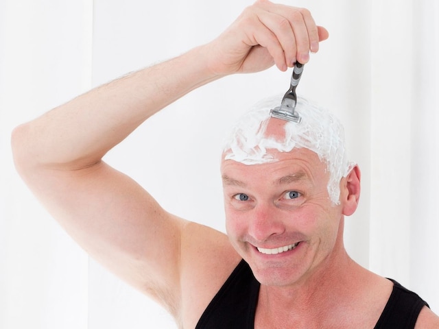 Can shaving your head eliminate the problem of dandruff? What do experts say