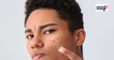 मुहांसों से परेशान? अपना तौलिया बदलें! जानें कौन सा फैब्रिक है आपकी त्वचा के लिए बेस्ट.